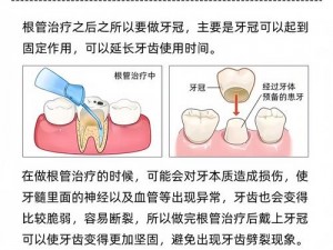 13岁PG可以塞下多少根牙【13 岁 PG 塞牙数量与牙齿健康有关，你想了解哪些方面呢？】