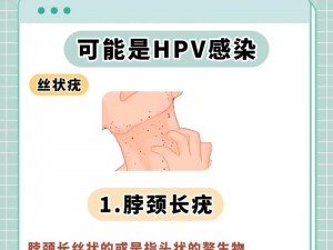 两个女人一个男人会怎样？HPV 感染的风险与应对策略