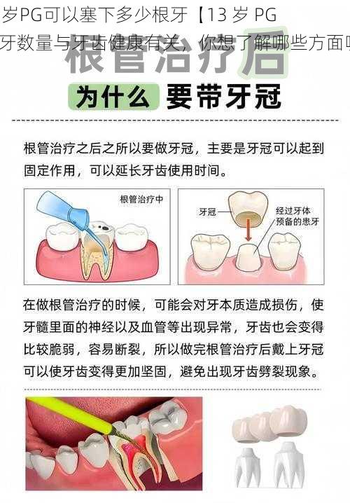 13岁PG可以塞下多少根牙【13 岁 PG 塞牙数量与牙齿健康有关，你想了解哪些方面呢？】