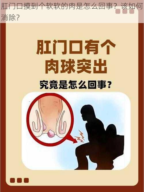 肛门口摸到个软软的肉是怎么回事？该如何消除？